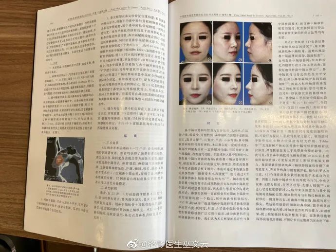 巫文云院长的《鼻中隔软骨形态的参数测量与分析》被学术期刊《中华医学美学美容》收录