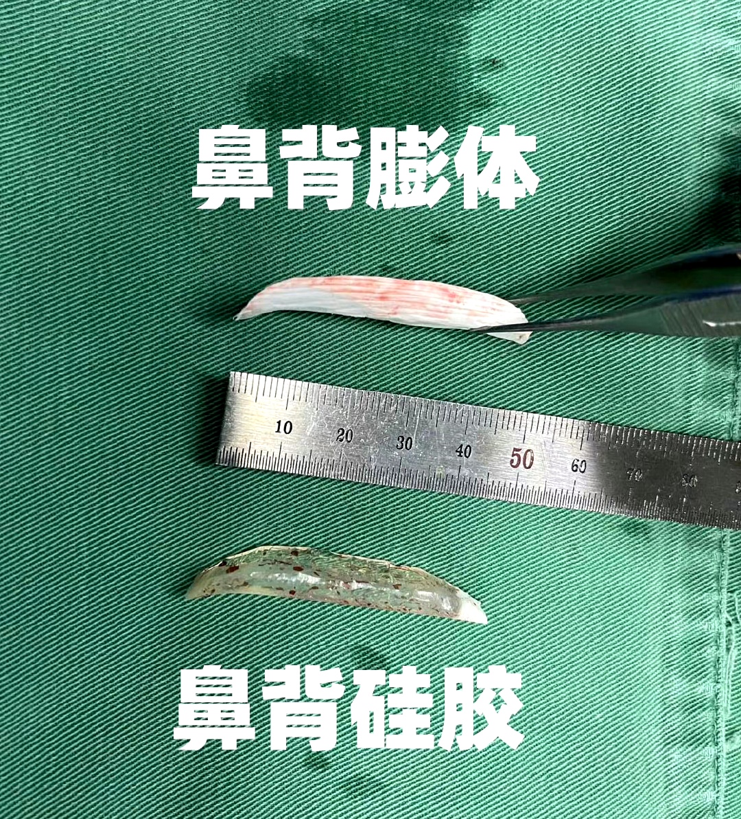 联合丽格第一医院洪春院长：膨体是否适合你的鼻子？