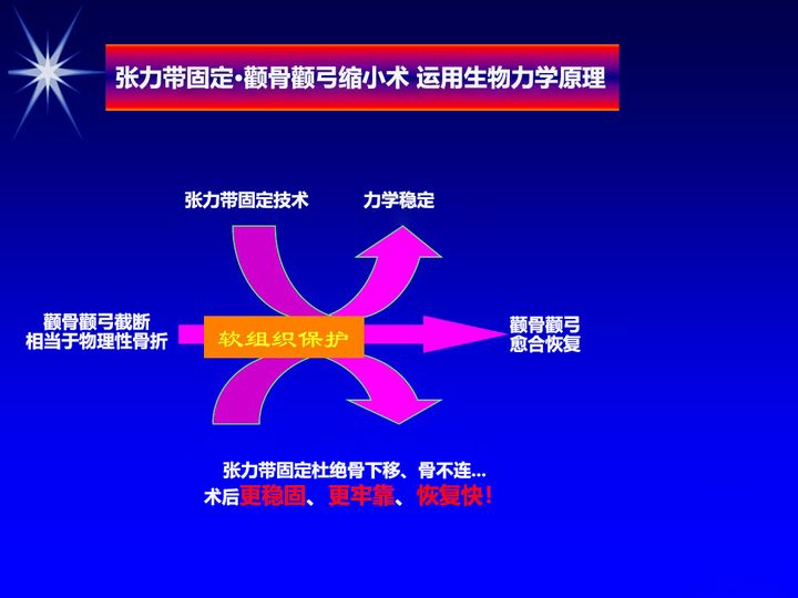 联合丽格第一医院何照华院长：张力带颧骨内推是如何固定的？为何术后它会更牢靠？