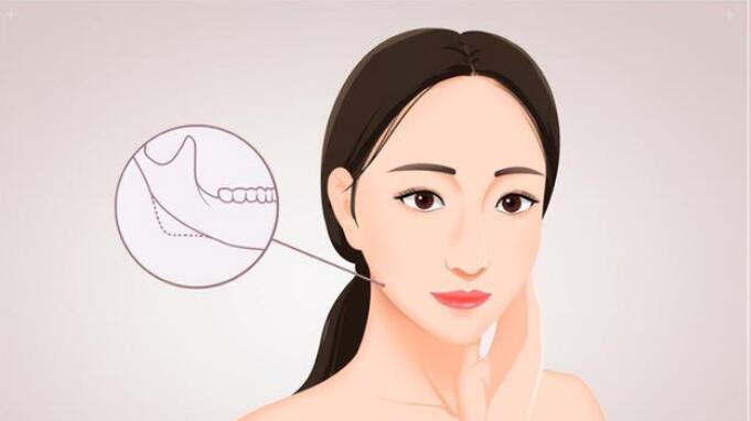 联合丽格第一医疗美容医院何照华院长：什么样的脸型更适合下颌角整形？